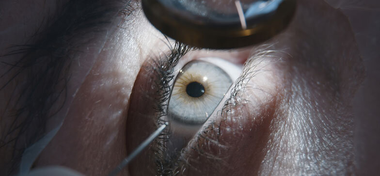 Eye Care Specialties | LASIK, Retina, Glaucoma & More